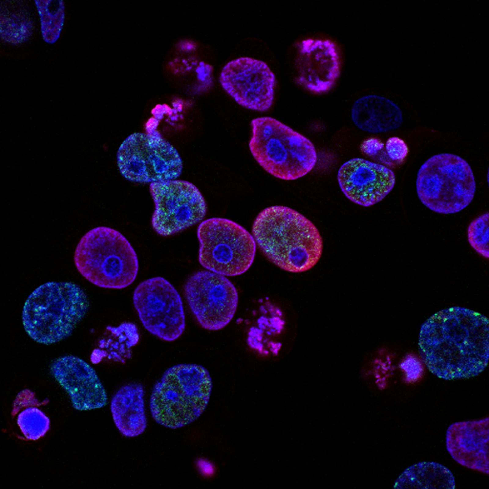Microscopy of stained cells in a research lab